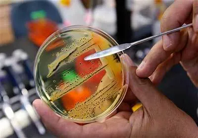 Trichomoniasis – Why Routine STD/STI Testing Is Important